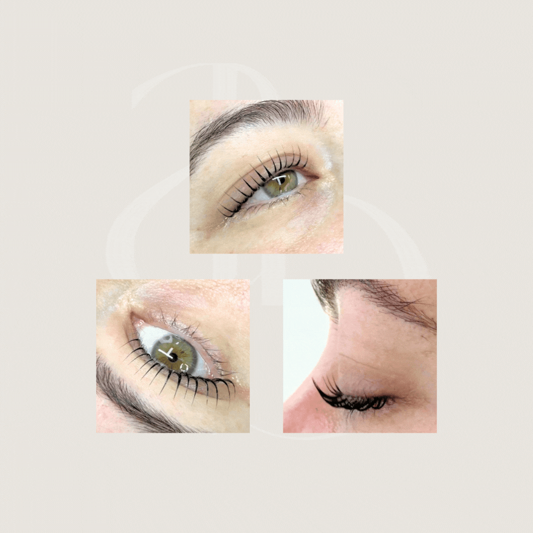 Extreme Lash Lifting Shields | Alba